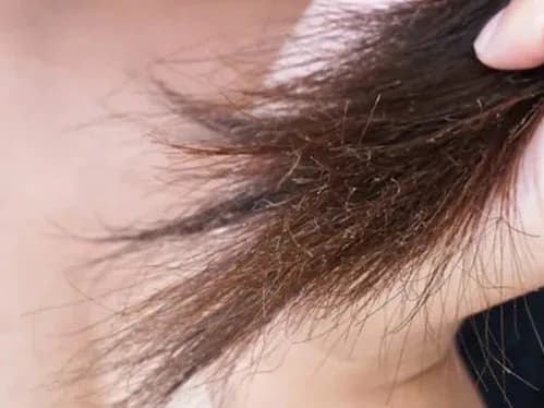 ఈ టిప్స్ పాటిస్తే మీ జుట్టు హెల్తీ గా మారుతుంది!