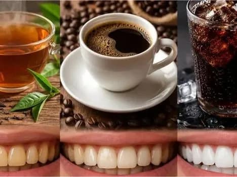 మీ పళ్లు సేఫ్‌గా ఉండాలంటే ఇలా చేయండి!