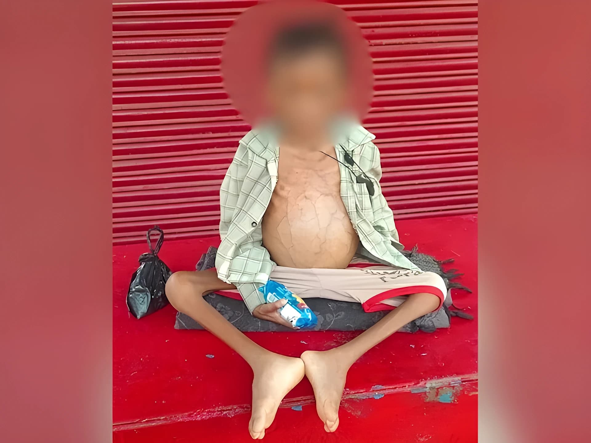 ఏడేళ్ల బాలుడి మృతి.. పోషకాహారం లేకే అంటున్న కుటుంబం