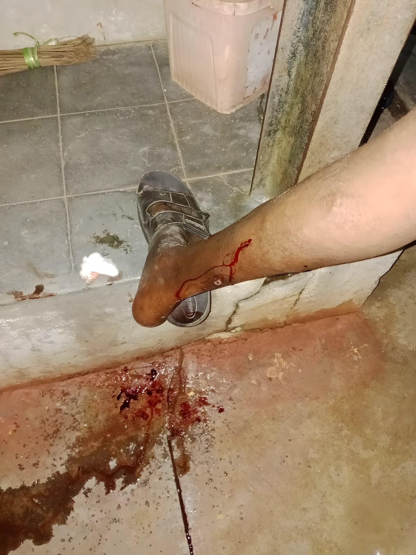 నాగర్‌కర్నూల్‌లో Dog అటాక్!