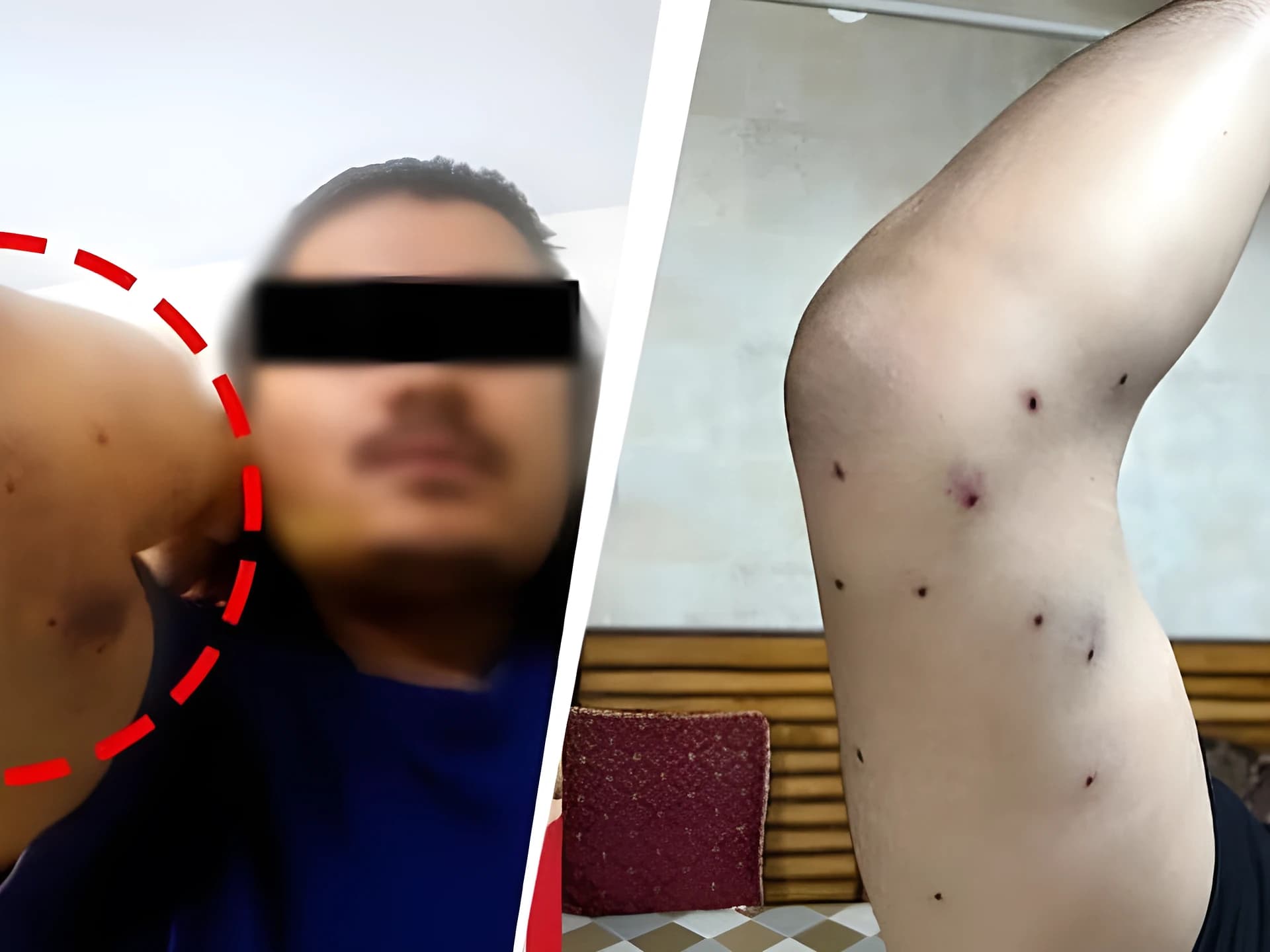 ప్లాస్టిక్ పెల్లెట్ గన్స్ వాడినది నిజమే !