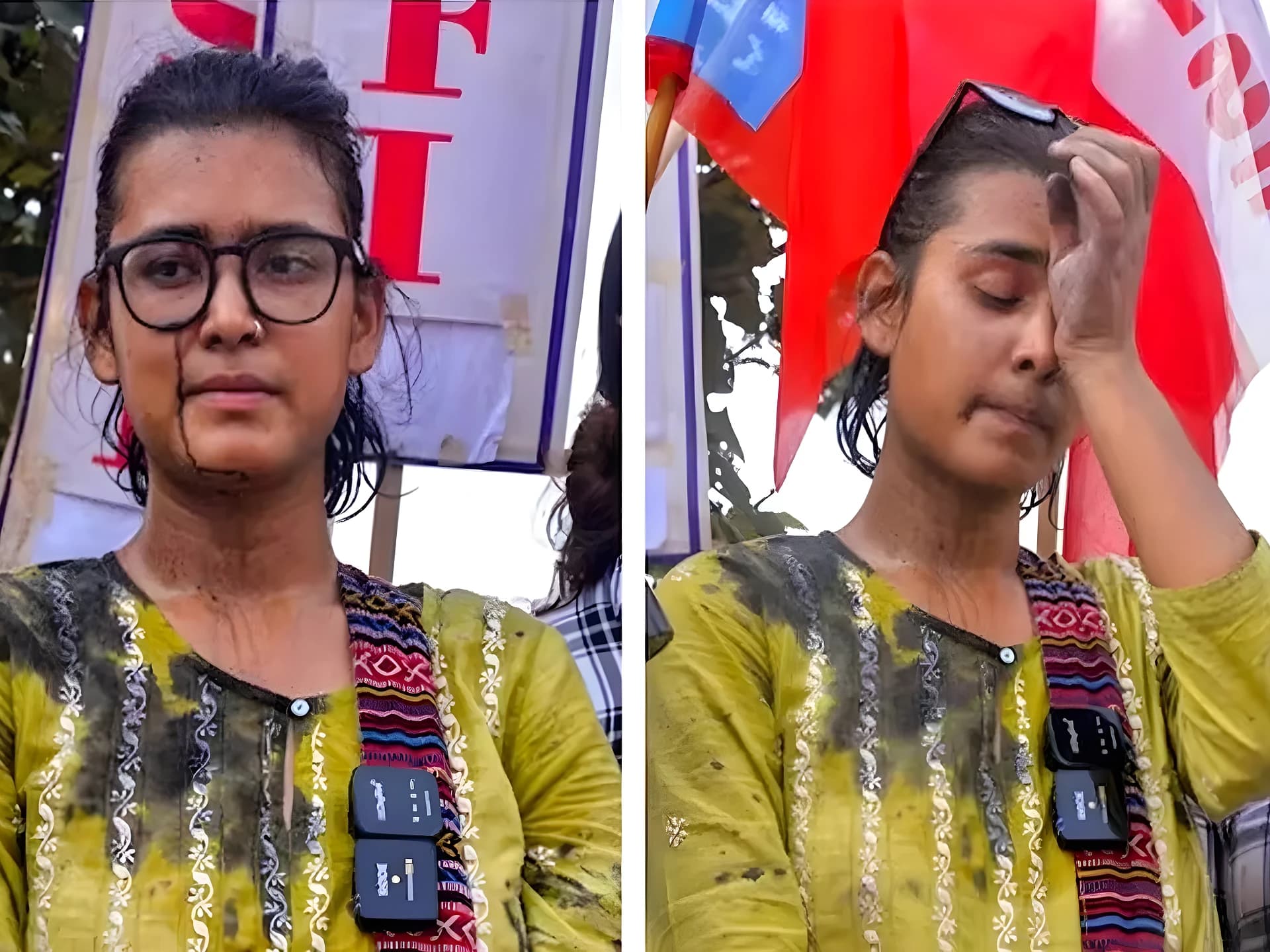 వేల మంది ముందరే ఇంక్ దాడి!