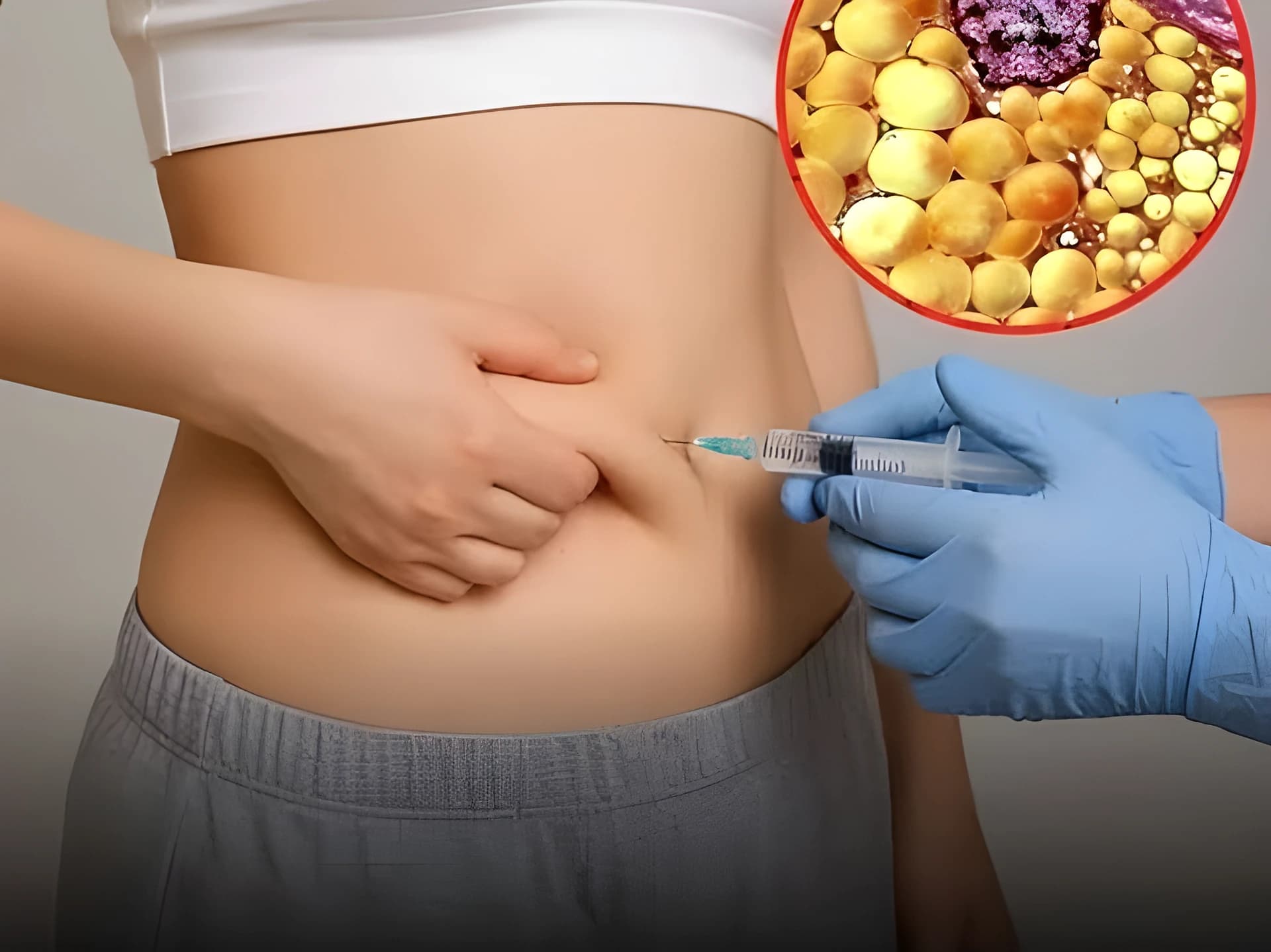 పొట్ట కొవ్వును తగ్గించే కొత్త ఇంజెక్షన్?