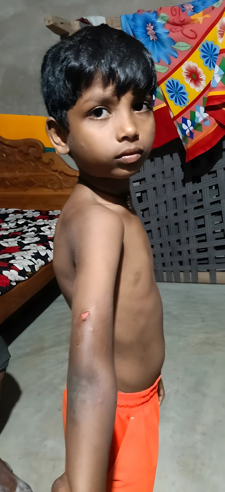 అయోధ్యలో కోతుల దాడి.. బాలుడికి తీవ్ర గాయాలు