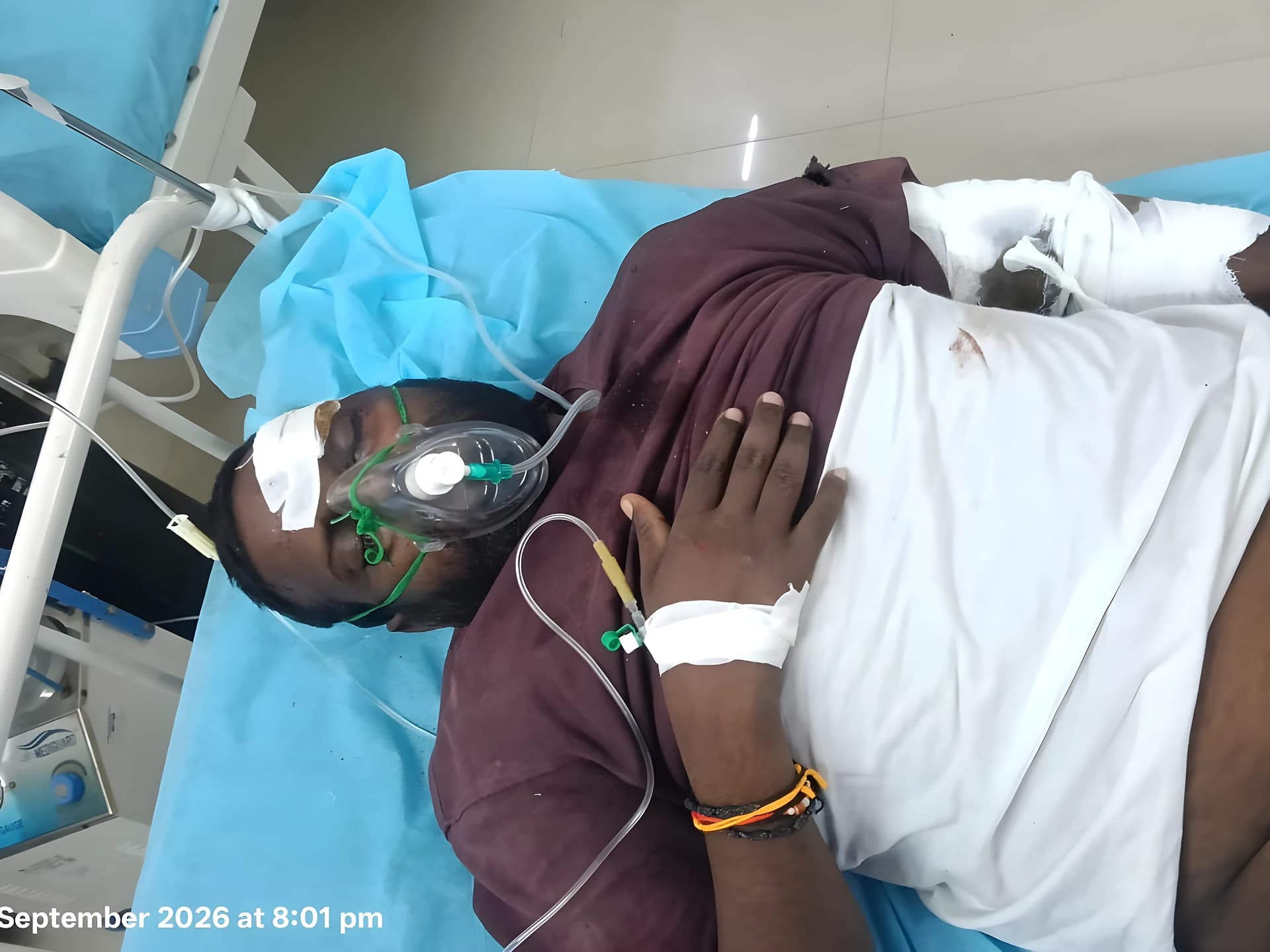 గేదె ఢీ.. బైకర్కు తీవ్ర గాయాలు!