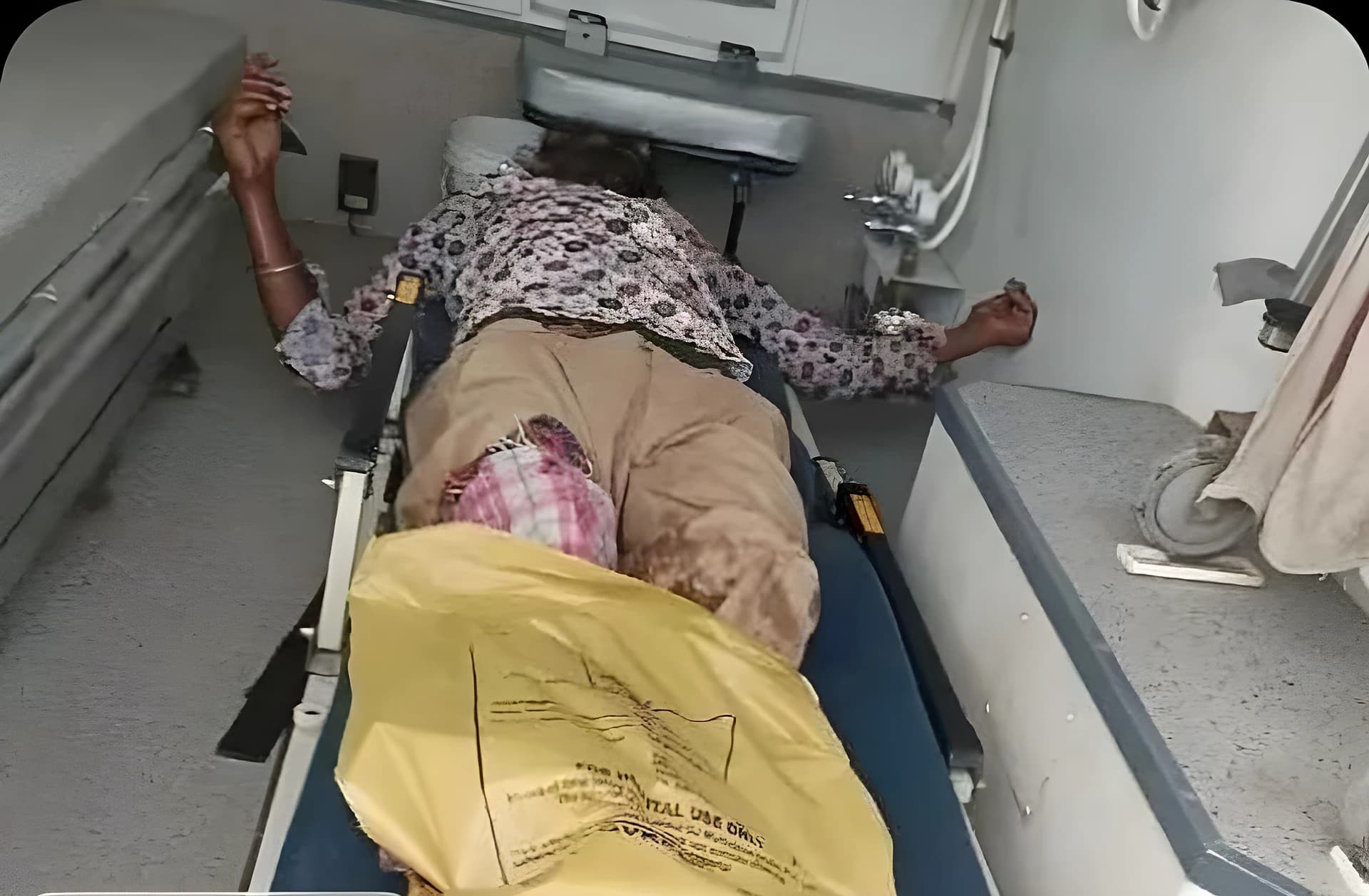 ఆర్టీసీ బస్సు కింద పడి వ్యక్తికి తీవ్రగాయాలు