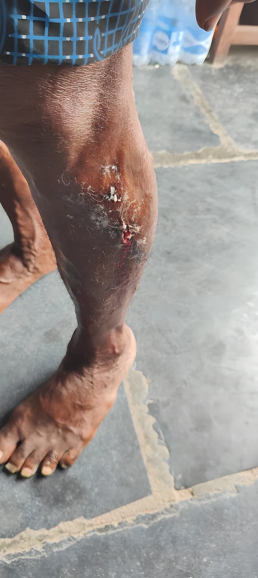 గుత్తి కోటలో కుక్కల టెర్రర్..